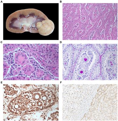 Case report: Renal adenoma in a captive ocelot (Leopardus pardalis) in Costa Rica